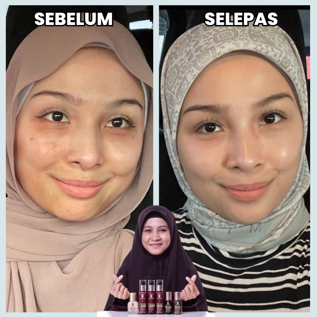 Testimoni sebelum dan selepas 1