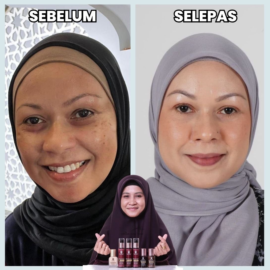 Testimoni sebelum dan selepas 4