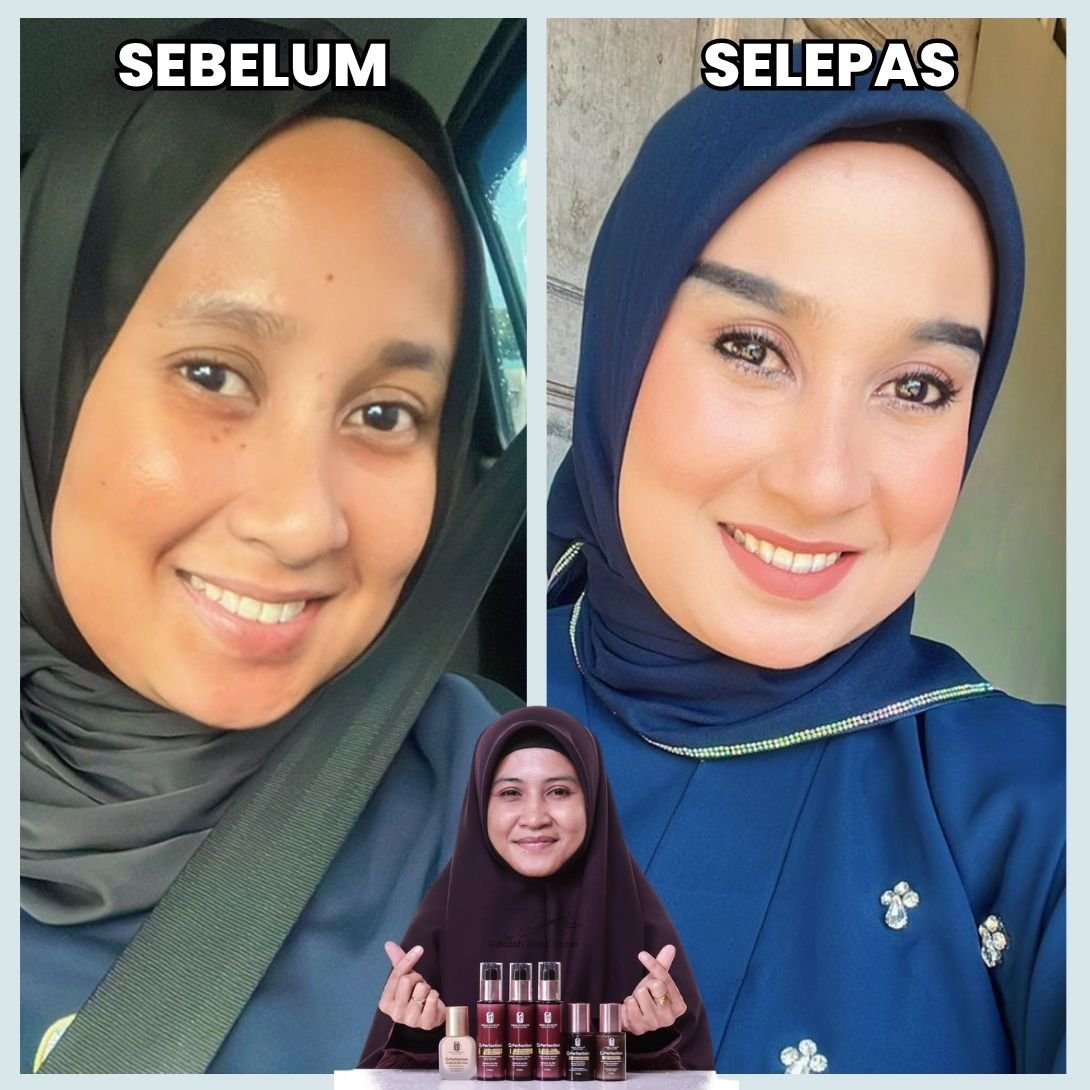 Testimoni sebelum dan selepas 5