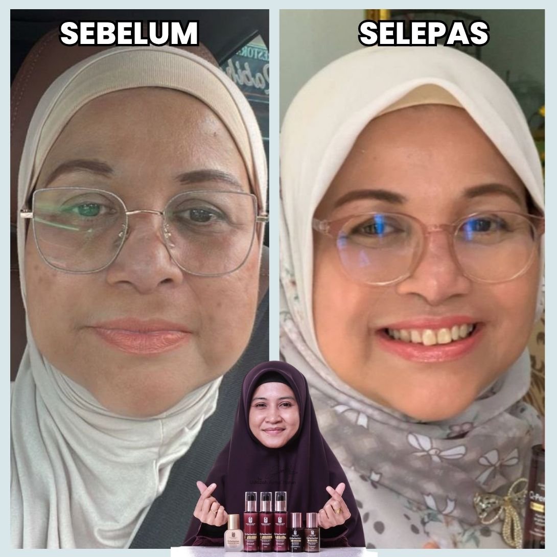Testimoni sebelum dan selepas 2