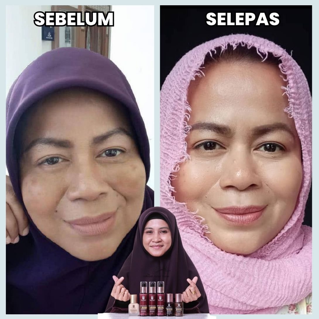 Testimoni sebelum dan selepas 3